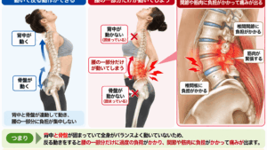 背中を反ると腰が痛いのはなぜ？原因と体の動きの関係