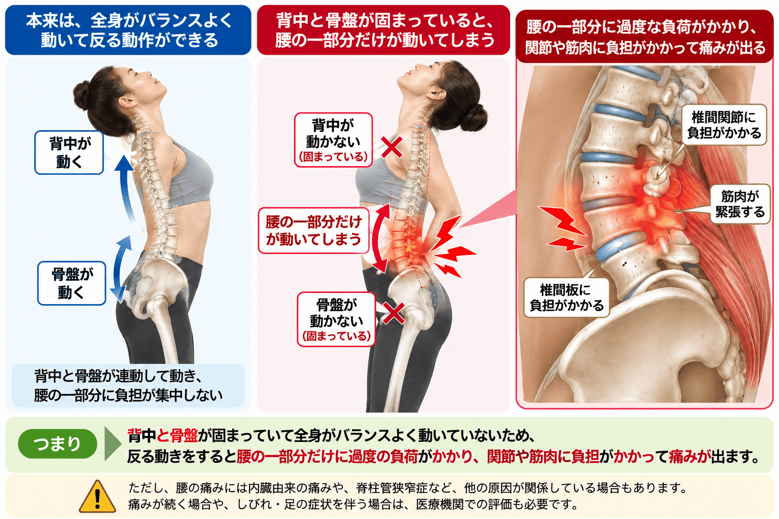 背中を反ると腰が痛いのはなぜ？原因と体の動きの関係